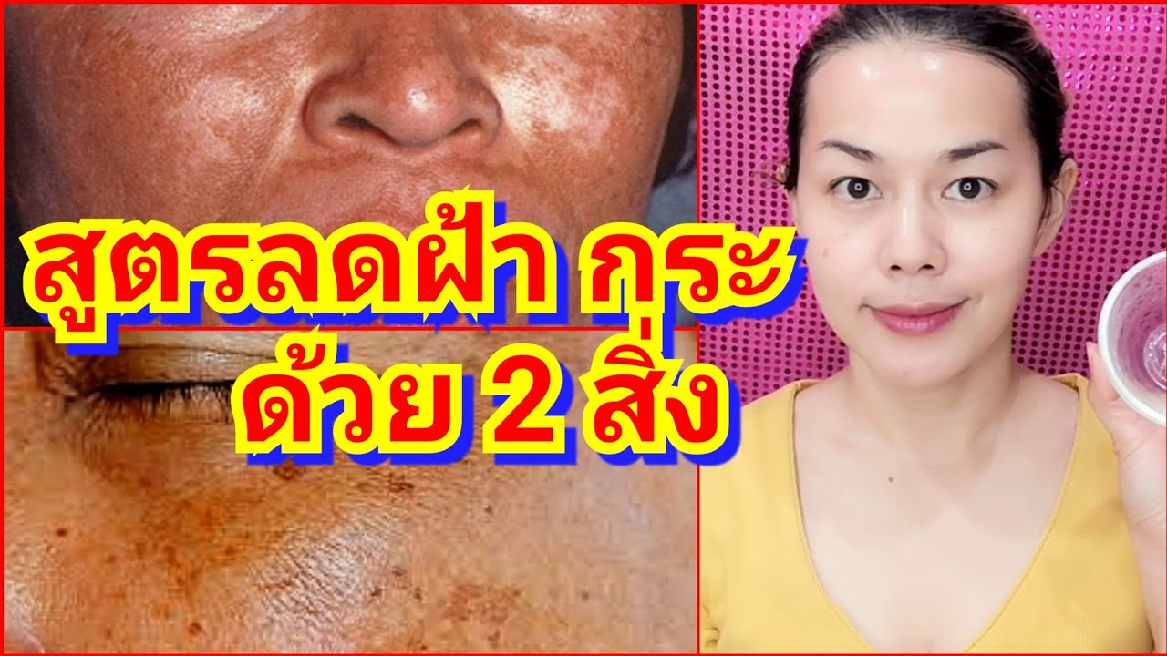 หน้า ขาว กระจ่าง ใส  New 2022  📍สูตรลดฝ้ากระ จุดด่างดำ ผิวหน้าขาวกระจ่างใส |แม่นายมาแชร์