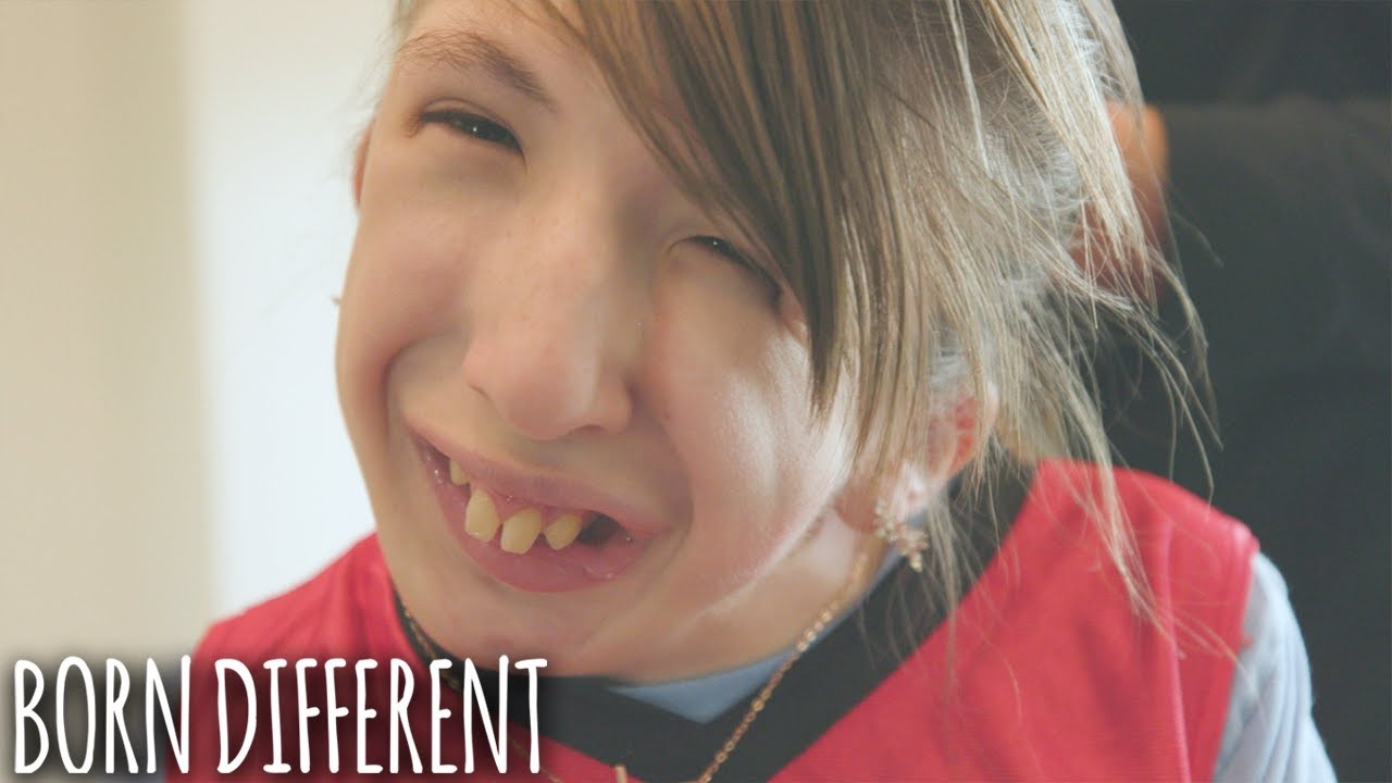 I've Had 33 Surgeries - And I'm Only 13 | BORN DIFFERENT