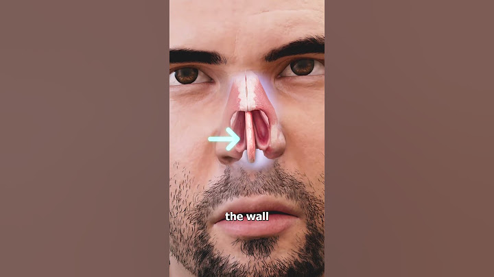 Picking Your Nose Can Cause a Hole 😨