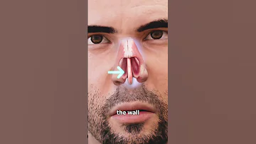 Picking Your Nose Can Cause A Hole 