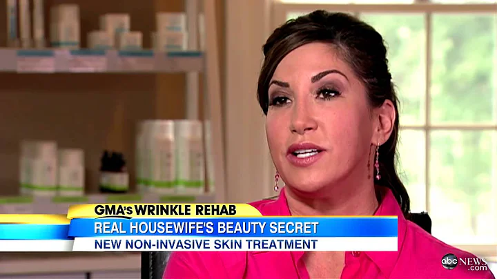 'Real Housewives'' Jacqueline Laurita Ultherapy Tr...