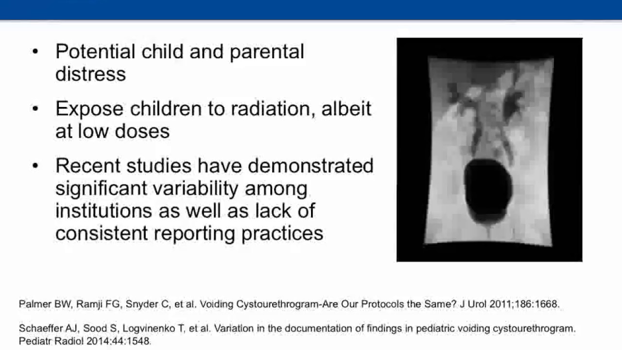 October 20, 2017: Angela Arlen, MD "Optimizing the VCUG: Distal Ureteral Diameter Ratio"