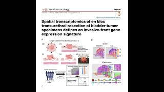 1272-Mapping Invasive-Front Signature of Bladder Cancer