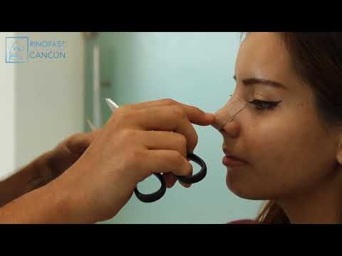 Como colocar cinta micropore en la nariz
