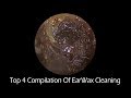 Top 4 Compilation Of EarWax Cleaning With Relaxing Music