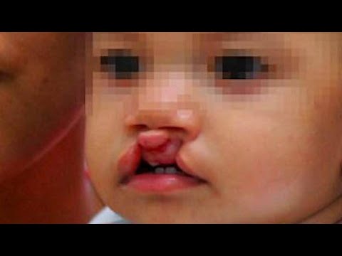 CURIOSIDADES DEL LABIO