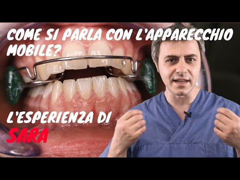 Come si parla con l&rsquo;apparecchio mobile? L&rsquo;esperienza di Sara