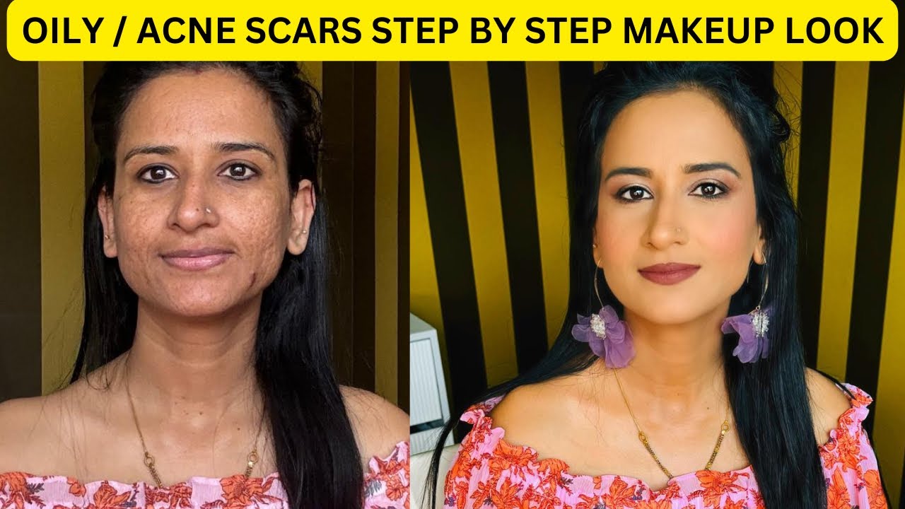 HOW TO COVER ACNE PRONE SKIN MAKEUP & HOW TO COVER ACNE | FLAWLESS FULL COVERAGE BASE| PRATIBHA