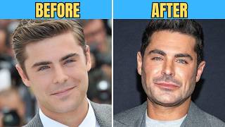 40 Celebrities Before and After Plastic Surgery ✅