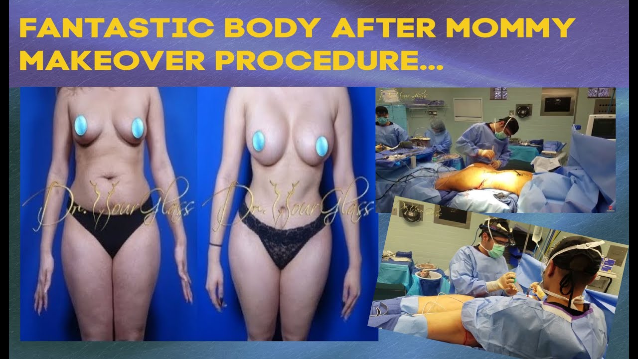 Beautiful Breasts and Waist After Mommy Makeover Procedure - Plastic  Surgeon