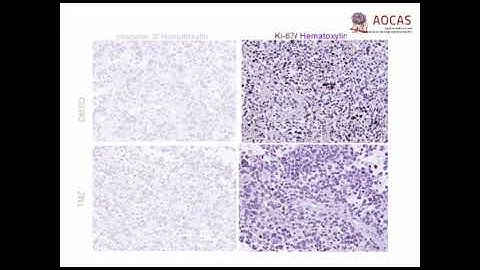 A new method in the development of anticancer drugs