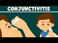 Conjunctivitis: What Is Pink Eye? | Types, Symptoms and Treatment | Video for Kids