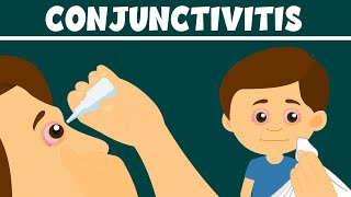 Conjunctivitis: What Is Pink Eye? | Types, Symptoms and Treatment | Video for Kids