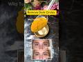Diy 💯 Dark Circles Removal🤩🤩 #shorts #darkcircles #viral #trending #skincare #eyes #diy #explore