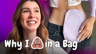 YBO: Living With Crohns Disease
Whats it like living with Crohns disease? We sat down with social media influencer Paula Sojo (@paulasojoro) to chat about her experience with Crohns.
00:00 Intro
00:48 Describe Your Journey with Crohn’s Disease
02:08 Why do you think this condition is so often misdiagnosed?
03:21 How do you mentally cope with Crohn’s disease?
04:09 What inspired you to talk about your experience online?
04:59 What is it like living with an ostomy bag?
05:22 What inspired you to design your own covers?
05:51 What is it like to date with Crohn’s disease?
06:50 Do you have any IBD icons?
08:14 What advice to a young person with Crohns, coming to terms with a diagnosis?
Questions or concerns? Contact us at https://underknown.com/contact/
Produced by the makers of What If. Check out our other channels:
What If - https://bit.ly/youtube-What-If
How to Survive: https://bit.ly/how-to-survive-show
Aperture: https://bit.ly/aperture-show
Crazy Creatures: https://bit.ly/crazy-creatures-show
Origins of Food: https://bit.ly/origins-of-food
Versus: https://bit.ly/versus-show
WTF Did I Just Watch: https://bit.ly/wtf-did-i-just-watch
Note: This video is not intended to be a substitute for professional advice, diagnosis, or treatment. Always seek the advice of your physician or another qualified health provider with any questions you may have regarding your health or a medical condition. Never disregard professional medical advice or delay in seeking it because of something you have seen on this channel. If you think you may have an emergency, call your doctor or the ambulance immediately. Underknown does not recommend or endorse any specific tests, physicians, products, procedures, opinions, or other information that may be mentioned in this video. Reliance on any information provided by Underknown is solely at your own risk. YBO: Living With Crohns Disease