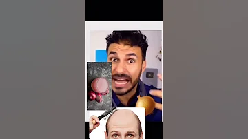 معجزات عصير البصل د كريم علي دكريم على فكر تاني Shortvideo Youtube Trending Video Story 