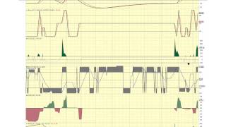 TGGI Trans Global Group Inc Stock Chart by Penny Stock Whispers