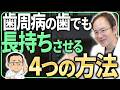 【歯周病の人必見】歯周病でも歯を失わないためにやるべきこと4選！歯周病の歯を長く使うためにできることをご紹介します
