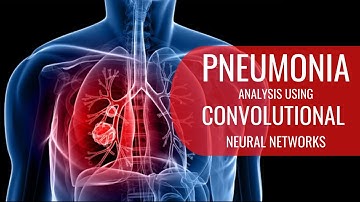Pneumonia Analysis using Convolutional Neural Networks, Tensorflow, Keras and Python