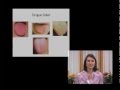 Tongue Diagnosis - Traditional Chinese Medicine and Acupuncture