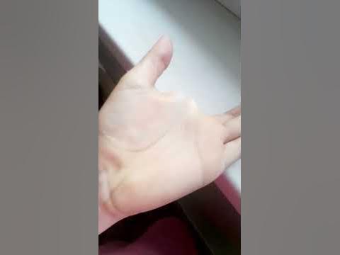 попалис 💓? - YouTube