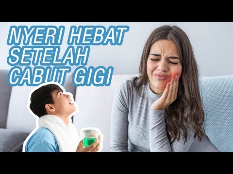 Video: 4 Cara Mencegah Soket Kering Setelah Pencabutan Gigi