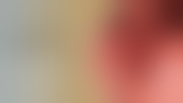 OTSC® System | Ulcer Dieulafoy hemostasis