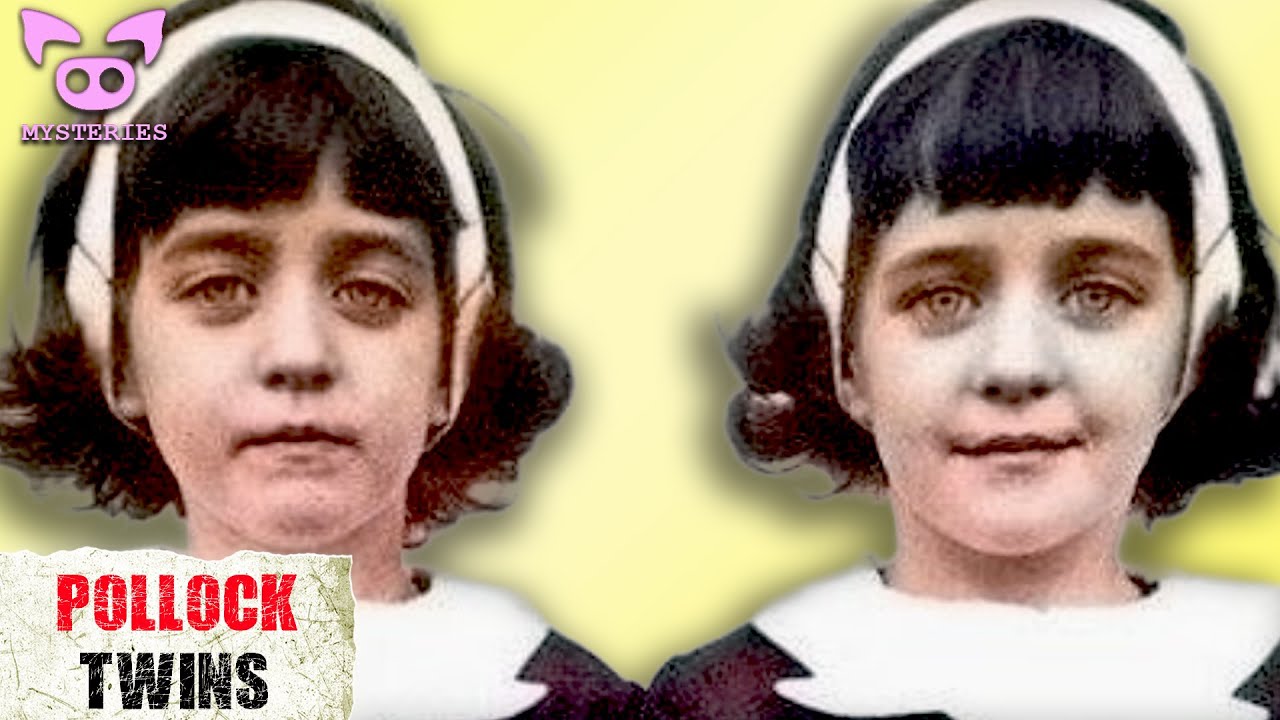 Are the Pollock Twins Proof of Reincarnation?