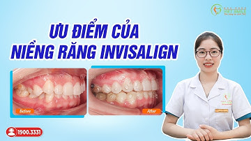 Ưu điểm của niềng răng trong suốt invisalign là gì? Bác sĩ chia sẻ