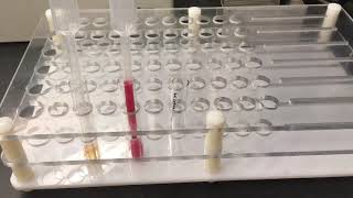 Blood Bank: Immediate Spin Crossmatch
