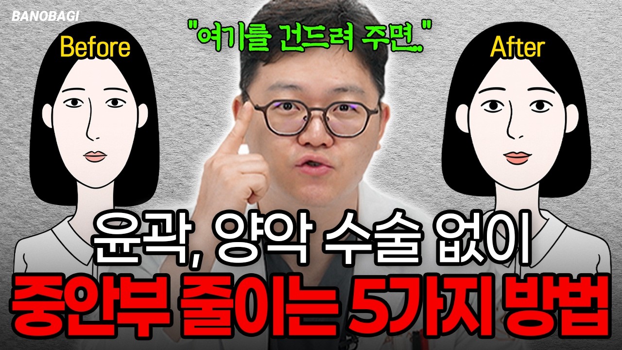 윤곽수술 양악수술 없이 중안면 줄이는 5가지 방법🔥중안부 긴 사람이 하면 더 길어 보이는 수술TOP3 #중안부