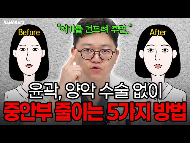 윤곽수술 양악수술 없이 중안면 줄이는 5가지 방법🔥중안부 긴 사람이 하면 더 길어 보이는 수술TOP3 #중안부