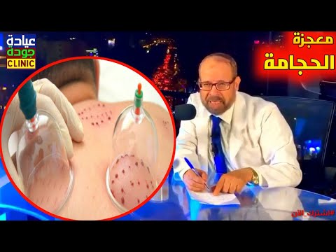 الحجامة كما لم تسمعها من قبل {علاج ببلاش}(١١)