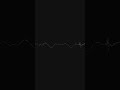 Sidi Hammouda Remix 