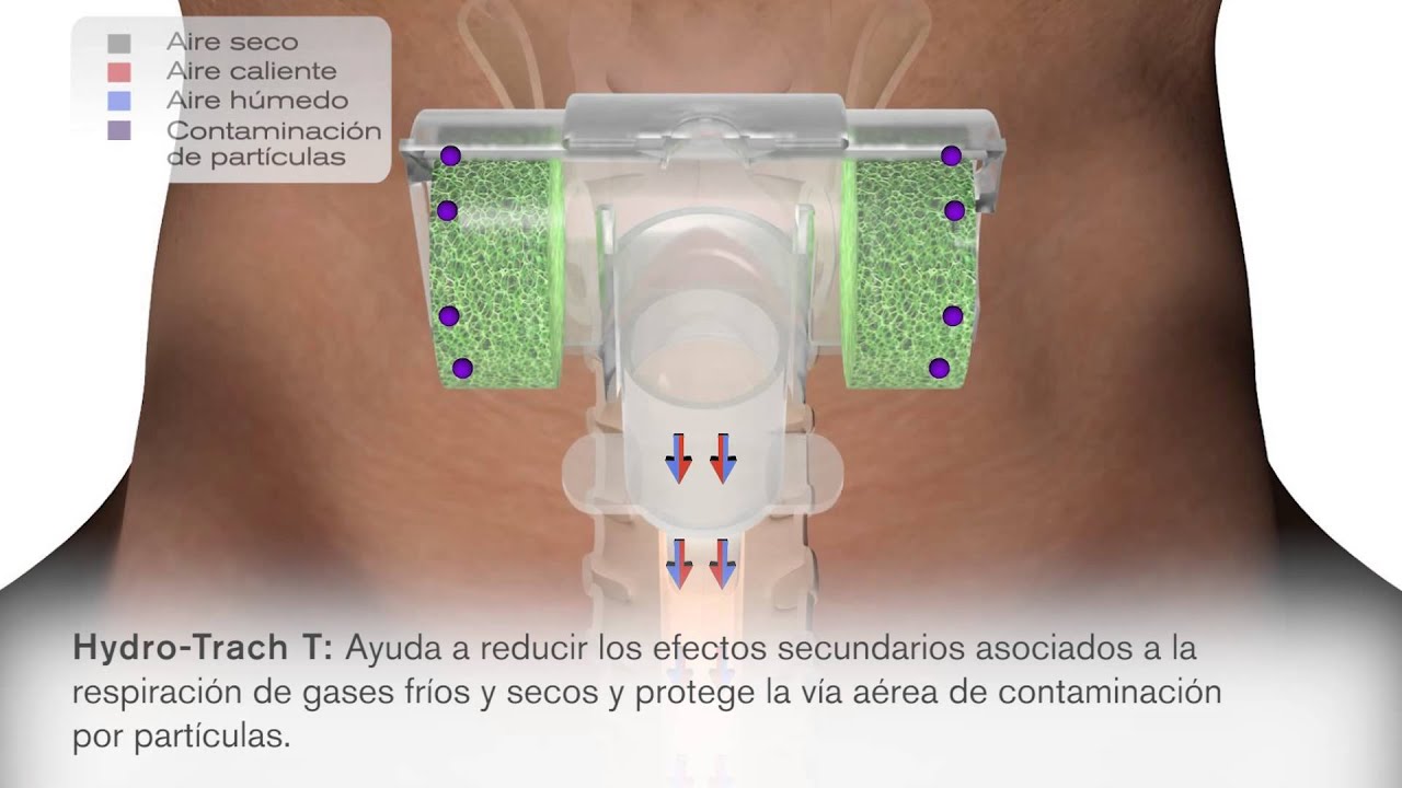 Para que sirve la filtracion