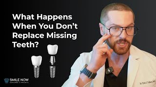 What Happens When You Don't Replace Missing Teeth?