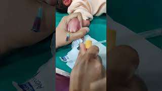 #shorts  Taking Venous blood sample in Newborn screenshot 3