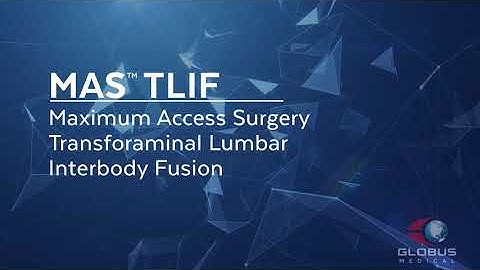 MAS TLIF - Patient Animation