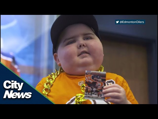 5-year-old boy battling brain cancer steals Edmonton Oilers' show (VIDEO)