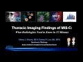 Thoracic Imaging Findings of MIS-C: What Radiologists Need to Know in 15 Minutes