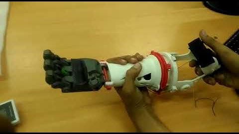 Open Source Hand Prosthetic Based 3D Printer for Children - iDIG Despro ITS