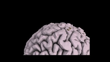 1st Place Winner of the BCI Award 2019: Decoding speech from dorsal motor cortex