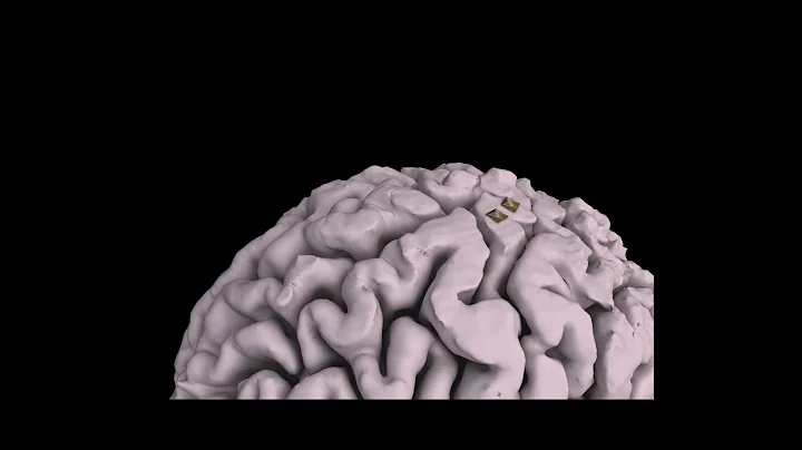 1st Place Winner of the BCI Award 2019: Decoding speech from dorsal motor cortex