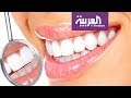 صباح العربية | طرق سريعة وحديثة لتبييض الأسنان
