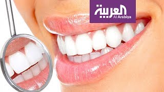 صباح العربية | طرق سريعة وحديثة لتبييض الأسنان