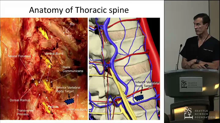 Approaches for Vertebral Augmentation - Doug Beall, MD