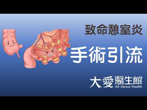 【大愛醫生館】 致命憩室炎 20260928