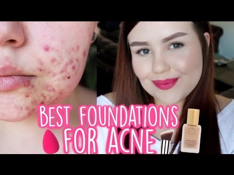 best foundation cystic acne
