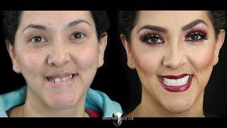 Watch Master Makeup Artist Get Smile Makeover Veneers- No Dentist- Brighter Image Lab