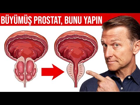 Video: Prostat Boyutu Nasıl Azaltılır: 13 Adım (Resimlerle)